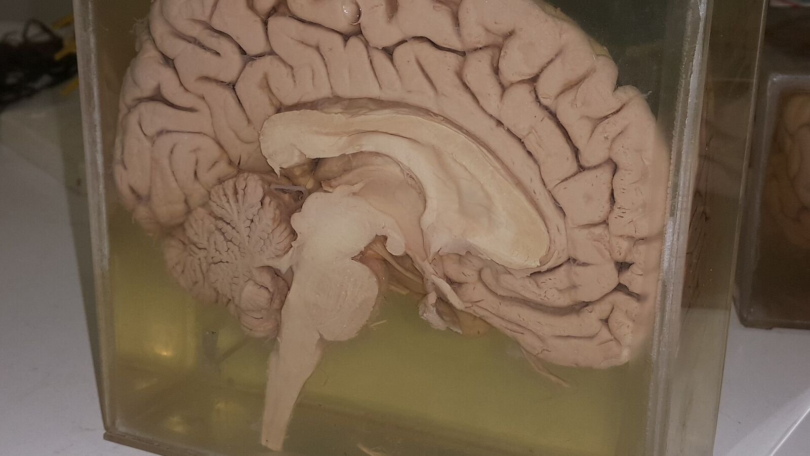 A human brain cut down the midline and preserved in fluid inside a clear specimen jar, showing the folded outer surface, the pale corpus callosum curving through the middle, the ridged cerebellum at the lower left and the brainstem beneath.