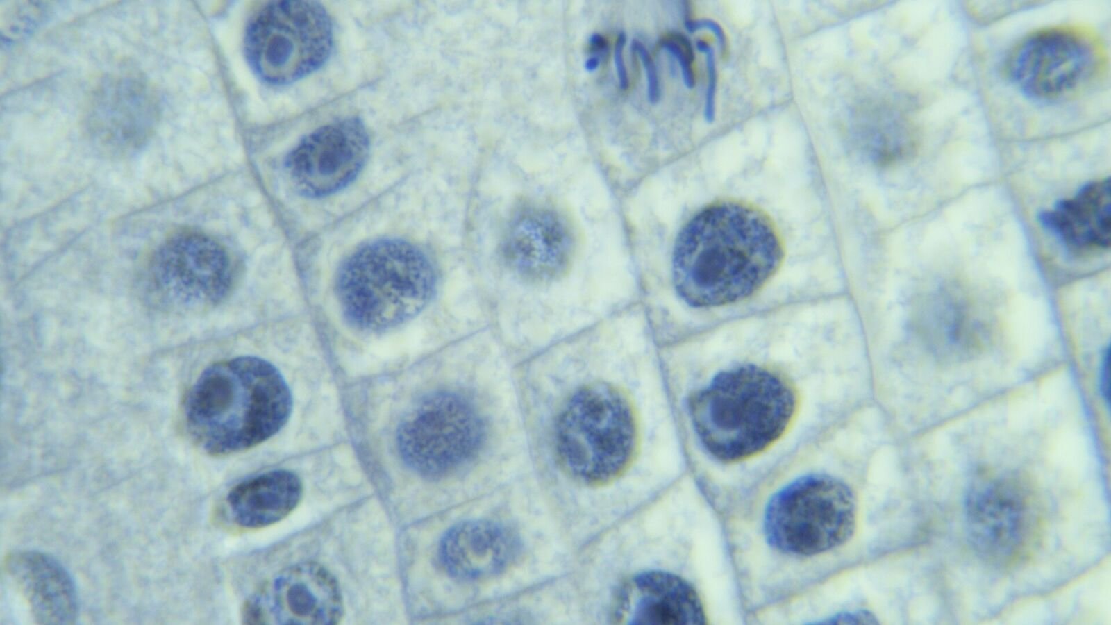 A light micrograph of blue-stained plant cells arranged in a rough grid, most containing a single round dark nucleus, with one cell near the top showing thick condensed chromosomes lined up in a bundle.
