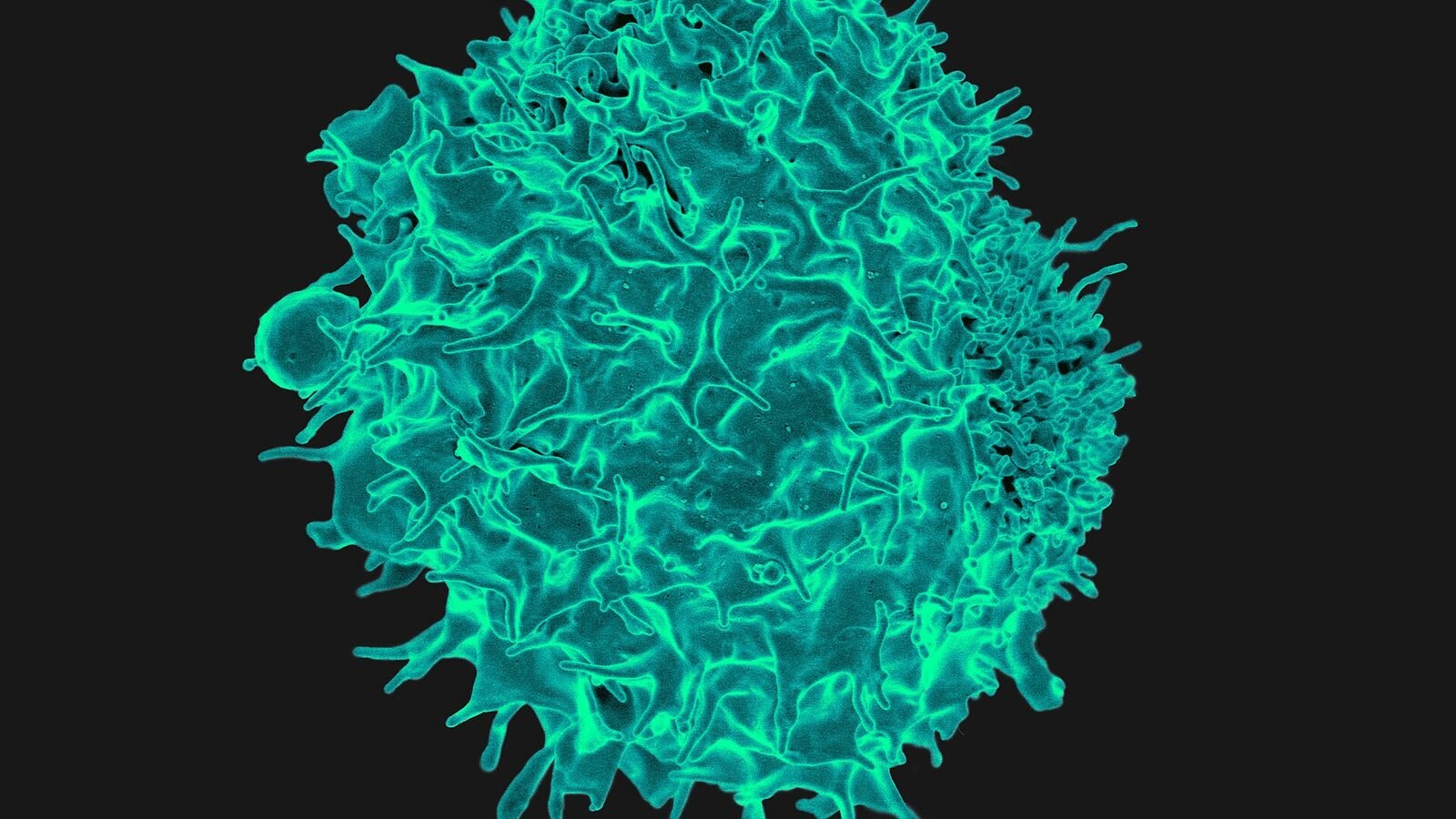 A colorized scanning electron micrograph of a single roughly spherical cell against a black background, its whole surface covered in teal ridges, folds and short finger-like projections.